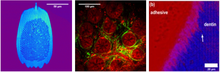 erythrocytes